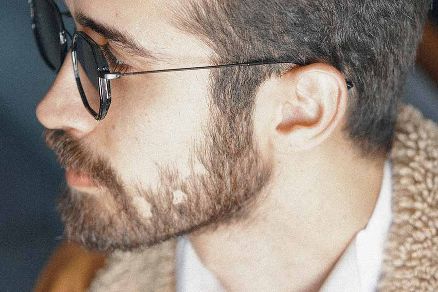 man with patchy beard